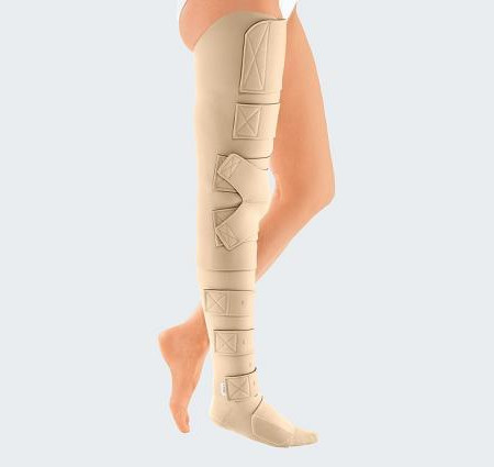 Close Compression Garments Lymphedema Edema Lipedema Stock Photo